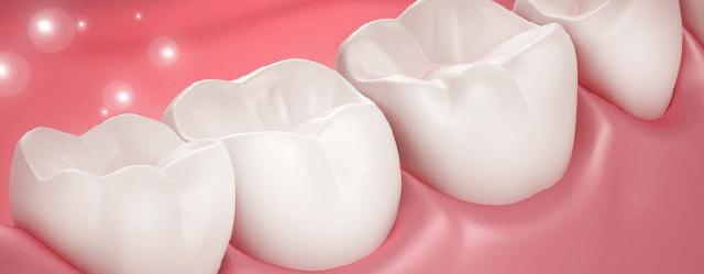 「牙齿那些事儿」No.64丨对于20岁的少年，种牙和镶牙哪个选择好