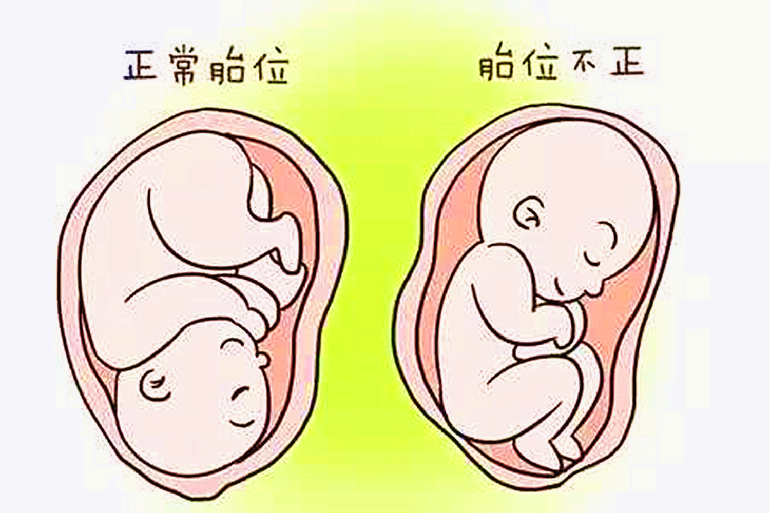 胎儿也会“打嗝”?别误以为是胎动,这几点需要孕妈妈们注意