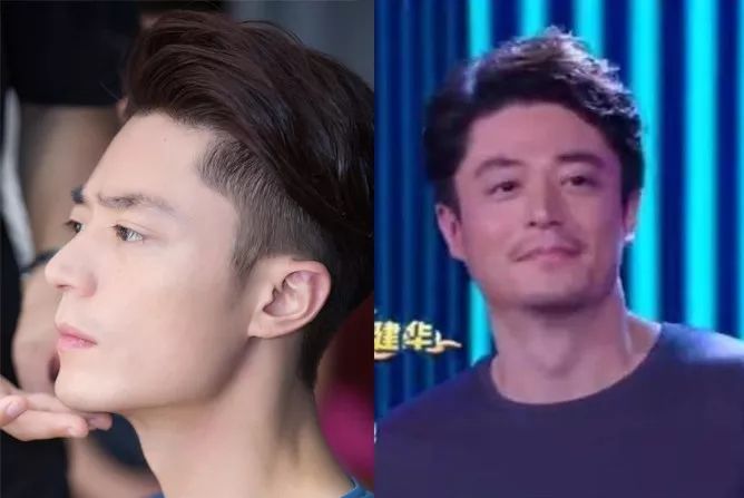 佟丽娅瘦脸前后判若两人不手术不打针如何瘦出一张无皱精致美人脸