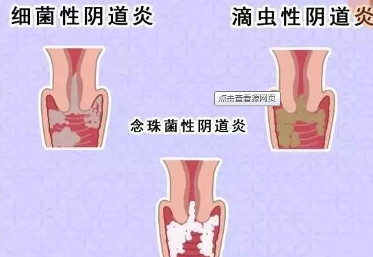 有什么防护措施,要做好哪些防护措施