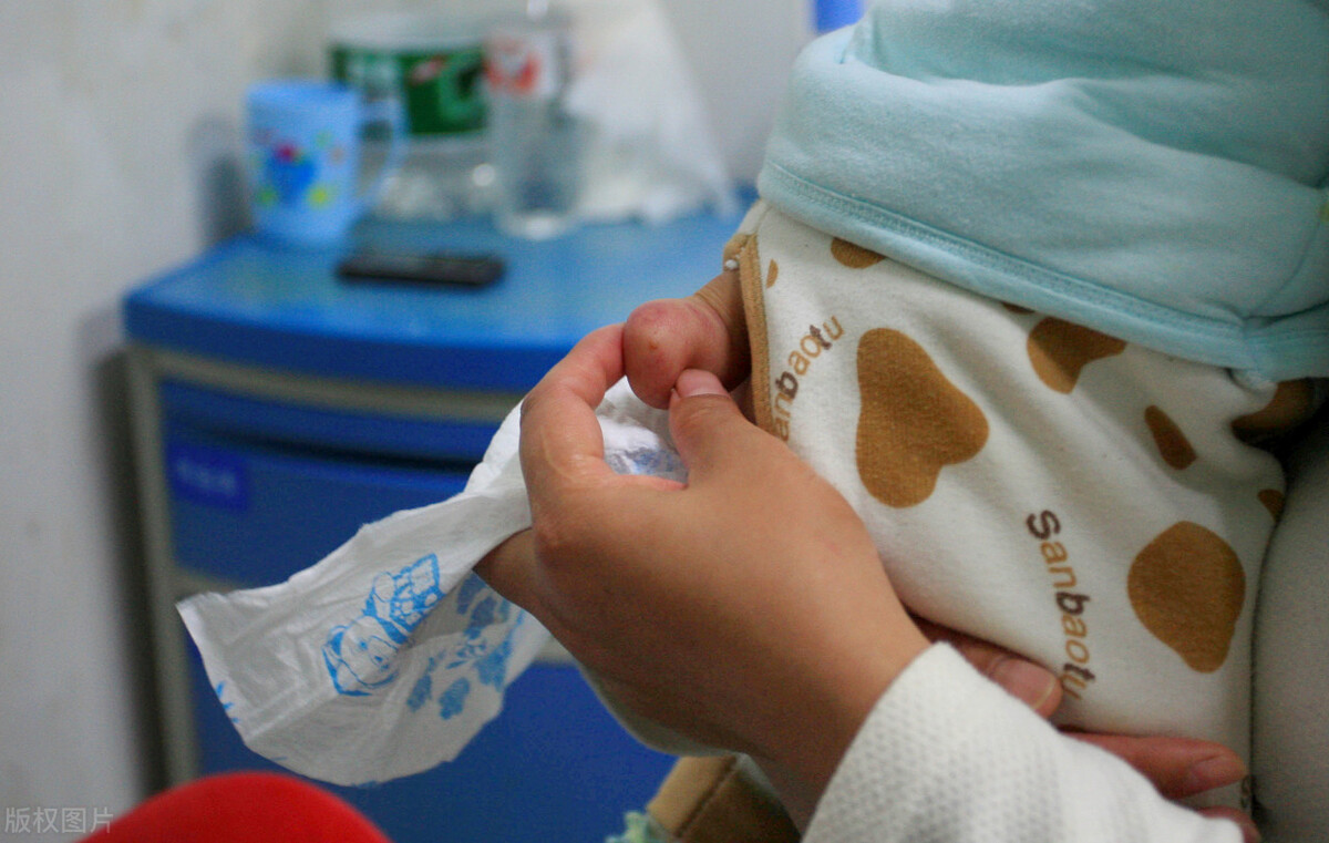 脊膜膨出后遗症大小便失禁,脊髓脊膜膨出手术多久能出院