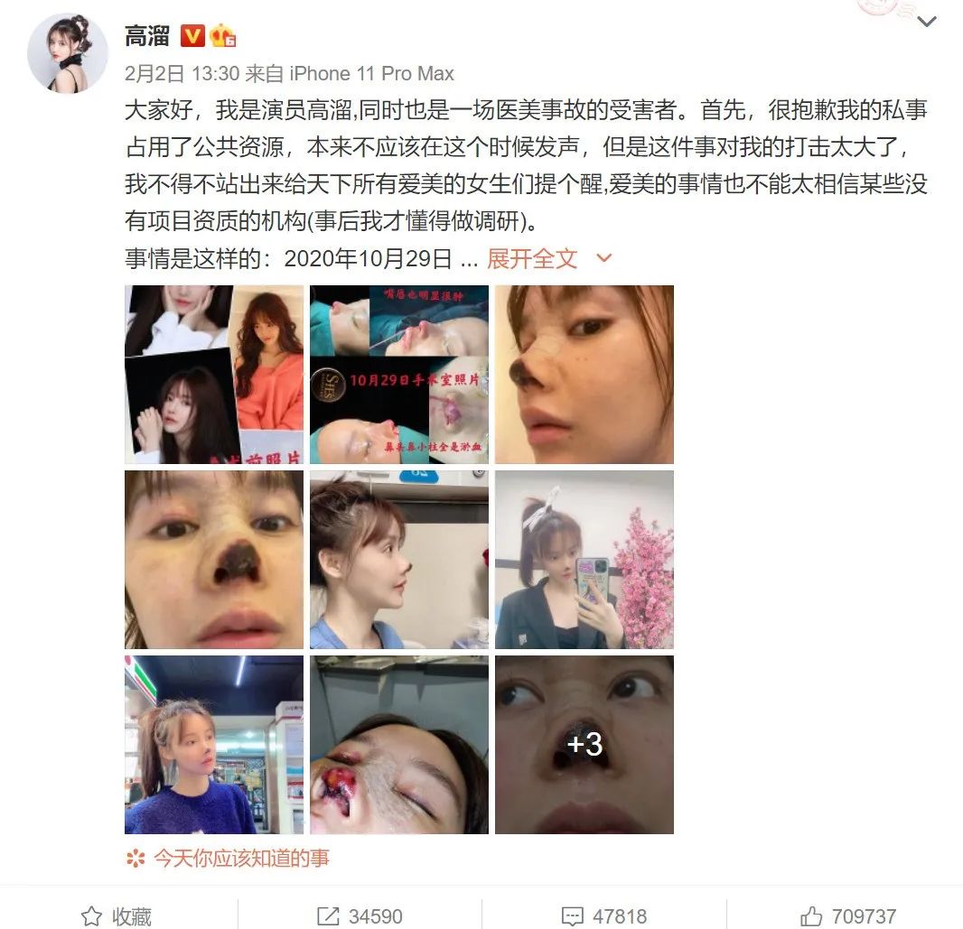 整容医院人爆满,上海整形医院人爆满视频