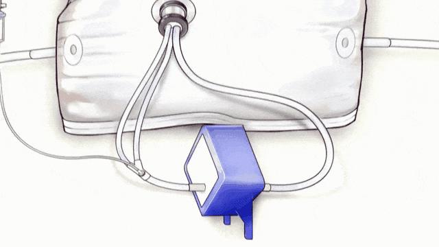 现在人造子宫成熟了吗,人造子宫是否会在2025年成功