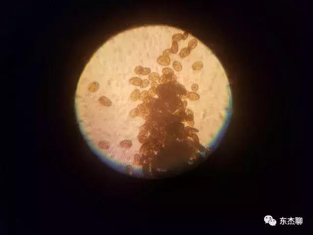 海水鱼缸藻类爆发怎么治,海水鱼缸的菌怎么处理