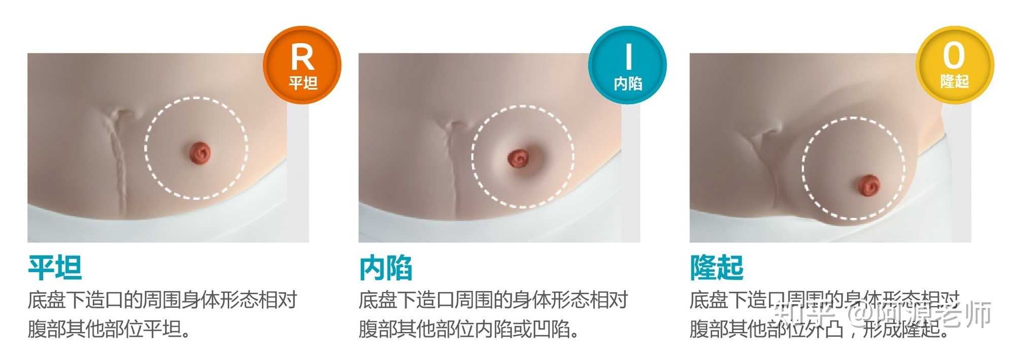 新冠疫情当下我们如何应对,新冠疫情下中国的应对措施