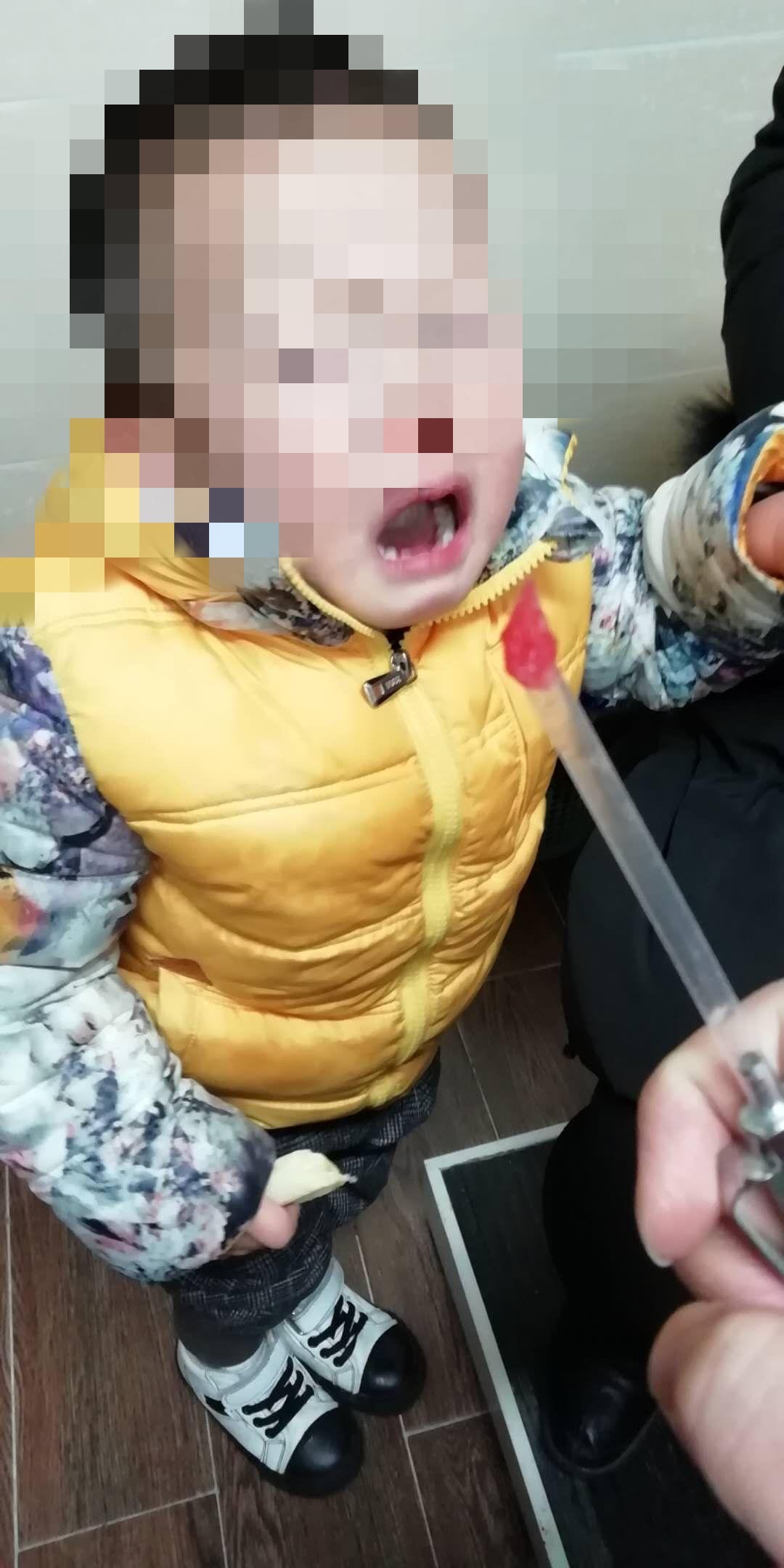 家长注意！徐州多名孩子鼻孔里出现了*珠钢**、西瓜、橡皮泥……