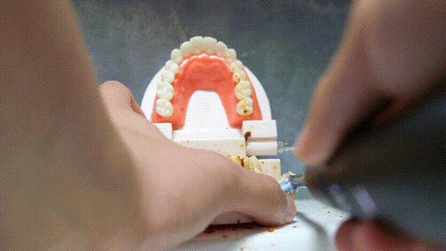 种植牙推荐电动牙刷,根据自己的牙选择电动牙刷