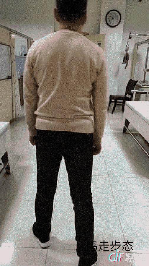 走路摇晃的元凶——臀中肌，看推拿师如何精准治疗？