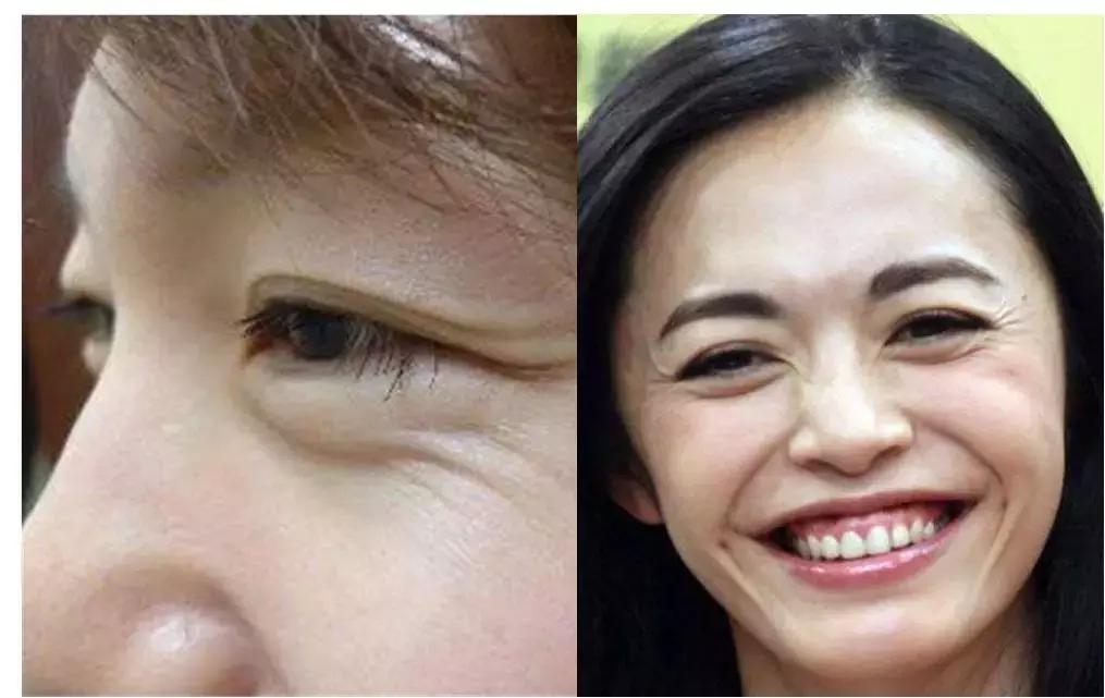 什么脸老了最容易显老,脸上有这5个特征的女人