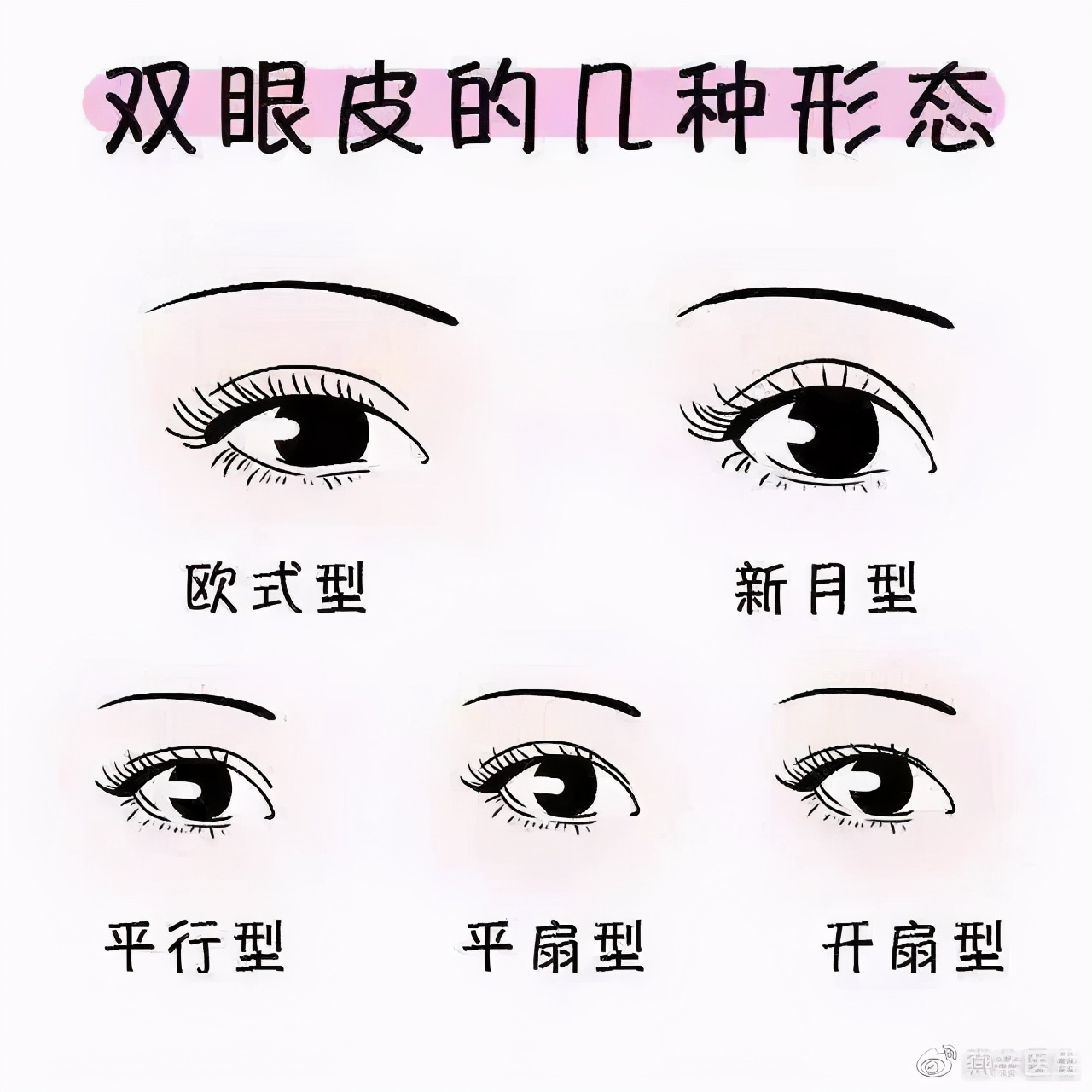 双眼皮修复科普,双眼皮修复要避免哪些坑
