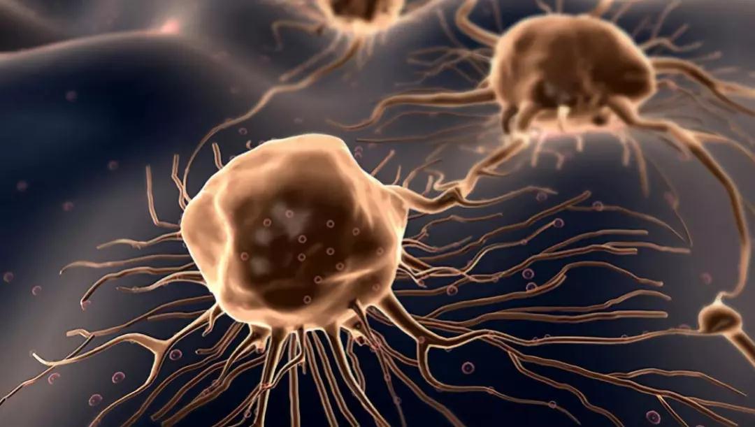 消化系统的恶性肿瘤性疾病，严重危害人们的身体健康，需及时治疗