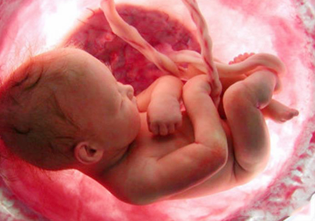 产检胎儿出生了,产检发现怀孕双胞胎