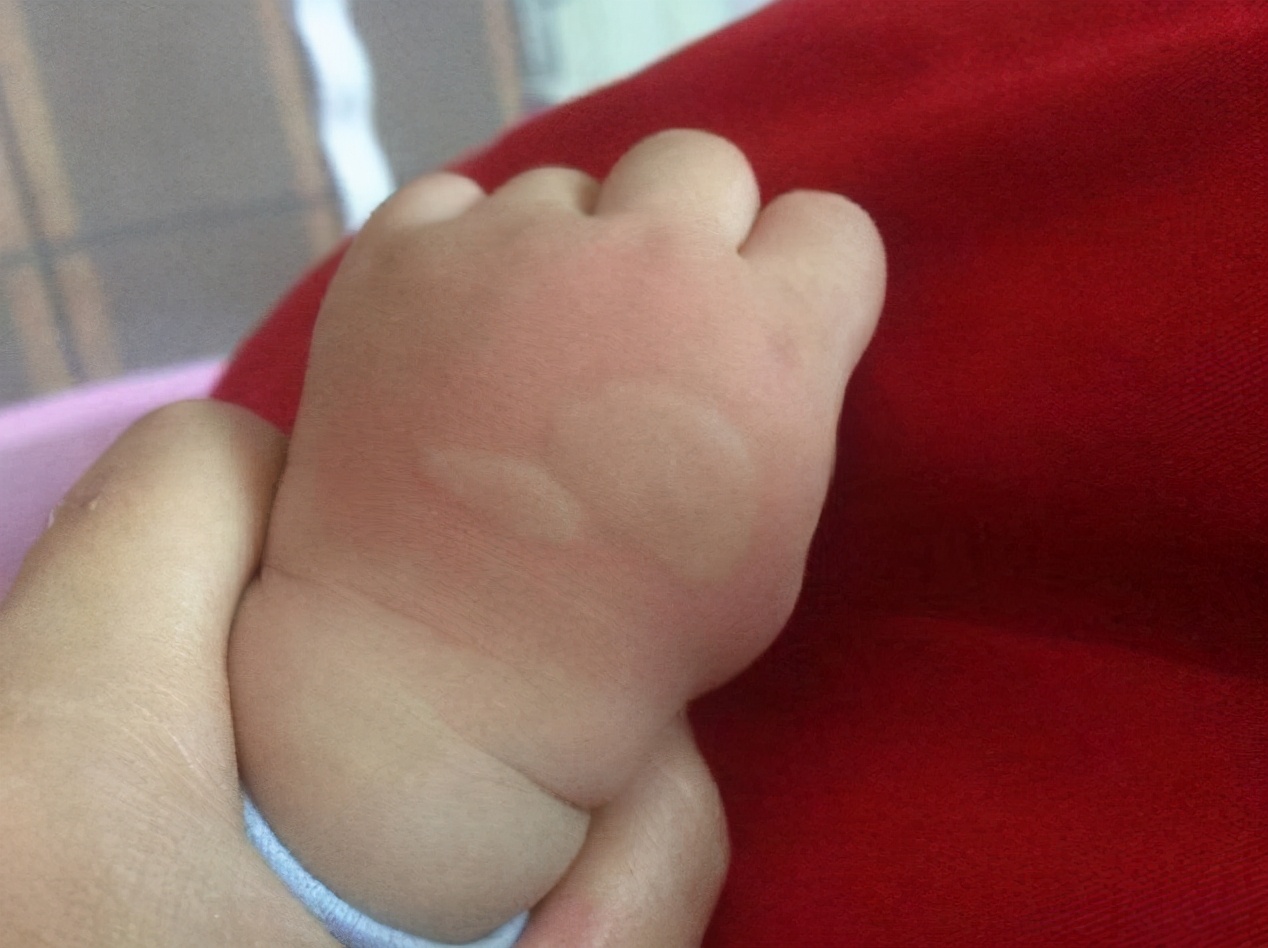 蚊子叮人会把人叮醒吗,蚊子叮人会吐旧血吗