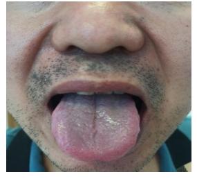 焦虑症引起的胃胀锻炼方法,焦虑症胃不舒服按摩哪个穴位好