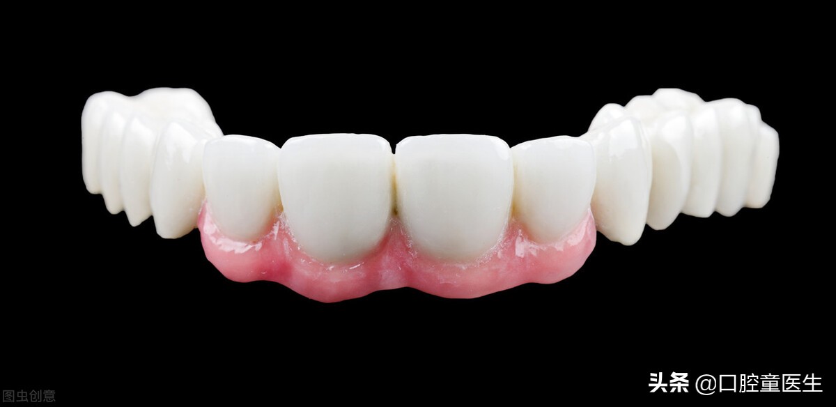 为什么医生说烤瓷冠跟全瓷冠一样,为什么医生推荐全瓷不让做烤瓷牙
