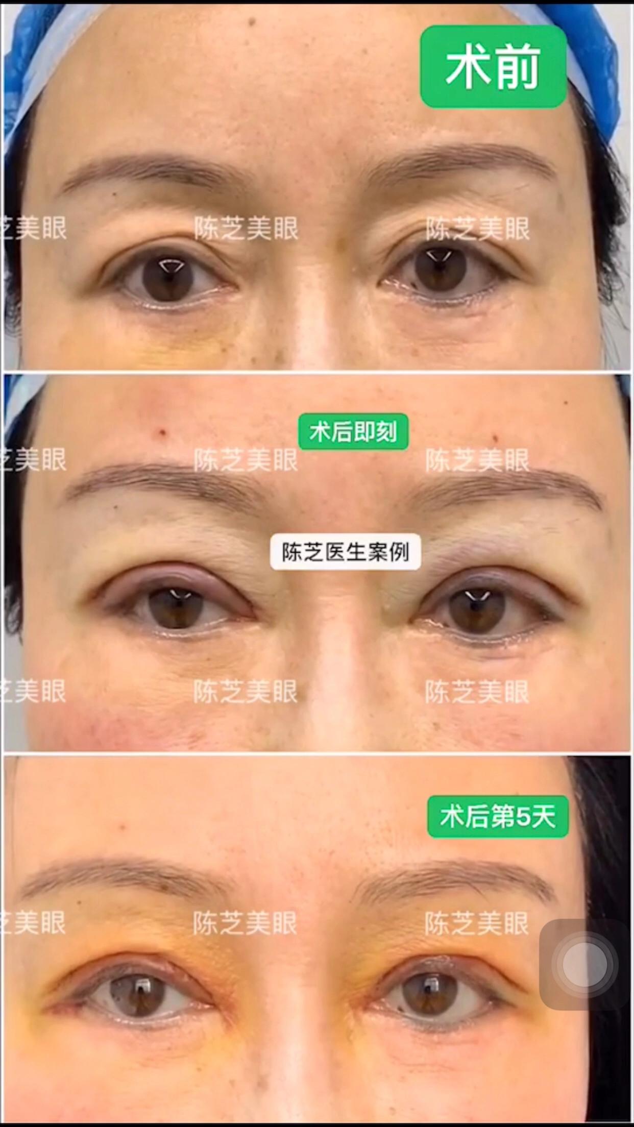 明明年纪不大却很显老态,明明年纪很小但是脸很显老