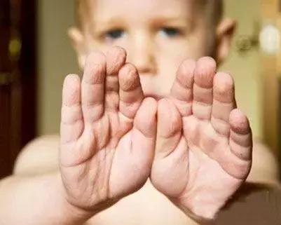 冬天这样护肤,睡觉都是“滑”进去的