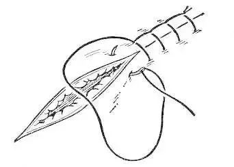 外科8种缝合方法图解,外科基本缝合方法实验报告
