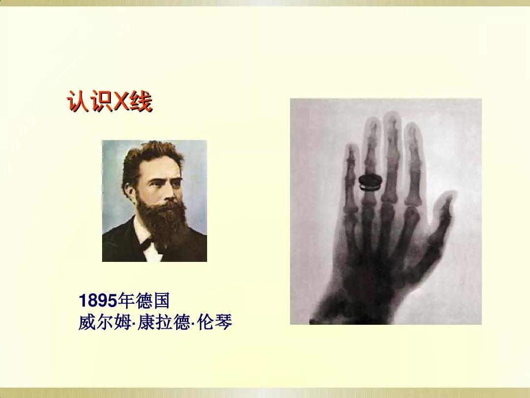 骨科x光片读片技巧,放射科骨科读片教程