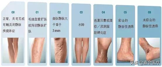 青花釉蚯蚓纹,宣德青花蚯蚓纹