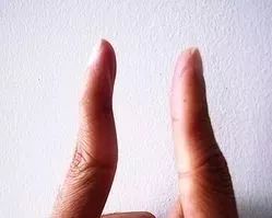 鼠标手疼痛如何缓解,手麻手抖手僵硬怎么办