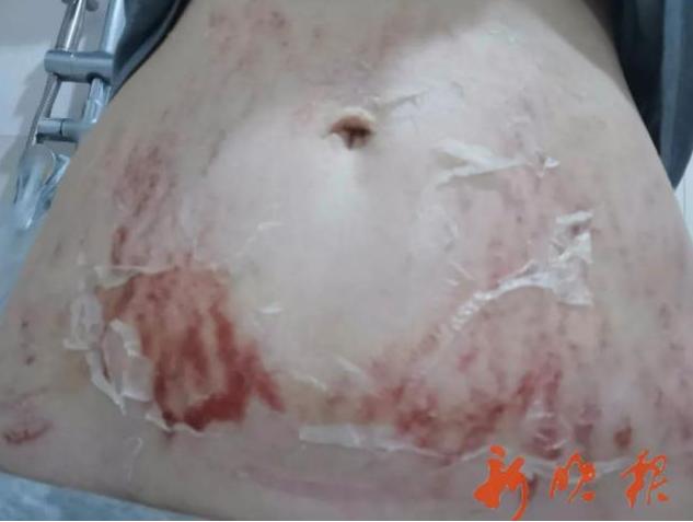 我拿命生孩子,你却嫌我肚皮丑