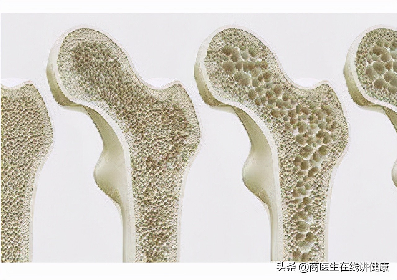 更年期女性为什么会得腱鞘炎,女性腱鞘炎怎么治疗效果最好