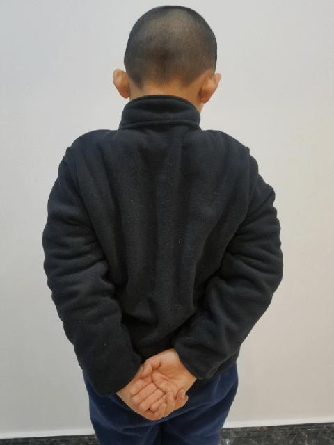 肩周炎胳膊疼痛怎样锻炼效果更好,肩周炎胳膊痛正确锻炼方法