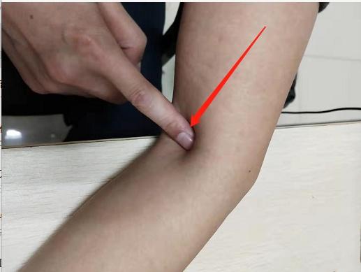 拍打肘窝出现紫痧治疗嗓子疼,小胳膊窝拍打出痧有哪些好处