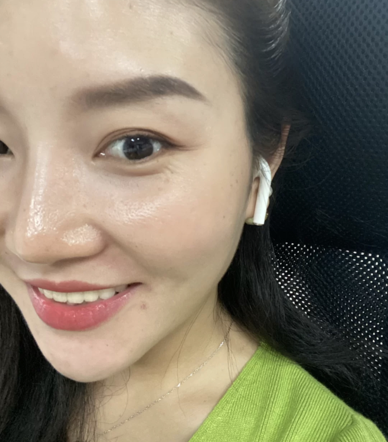 眼尾有皱纹怎么治疗,眼尾沟里面有皱纹怎么办