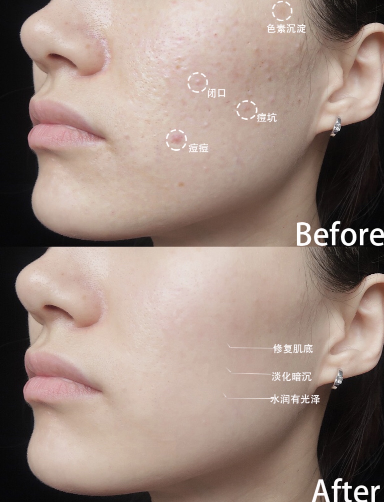 6代水乳精华三合一测评,大瓶美白补水保湿抗皱紧致精华水