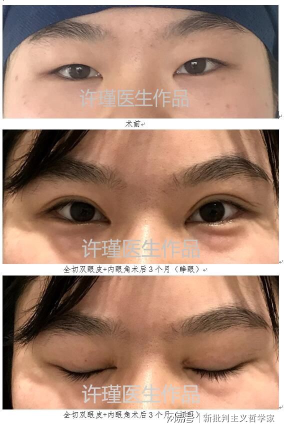 名医专访丨上海交通大学医学院附属同仁医院许瑾：面部美容整形