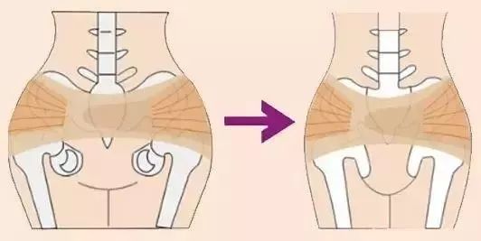 盆骨胀痛是什么原因,来大姨妈盆骨两侧酸胀