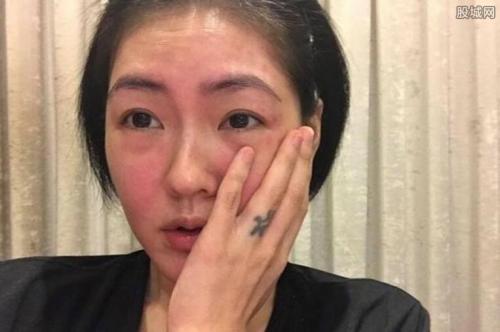 遇事容易紧张脸红怎么办,遇事紧张心慌发抖怎么治疗