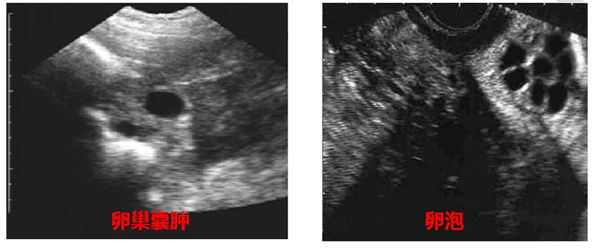 怎么判断母猪可以授精,母猪人工授精怀孕技术