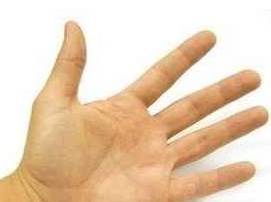 手掌什么颜色代表疾病及图片,手掌各个穴位的颜色反映什么疾病?