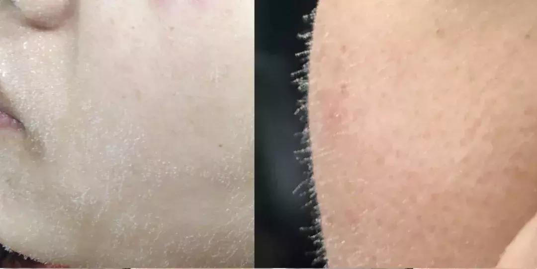 有了前法国第一夫人的百元“黑科技”眼霜，我把3000块眼霜扔了！