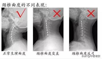 77岁tvb老戏骨近况,70岁tvb老戏骨中风