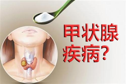 预防甲状腺最好的方法是食用碘盐,甲状腺结节碘盐要求