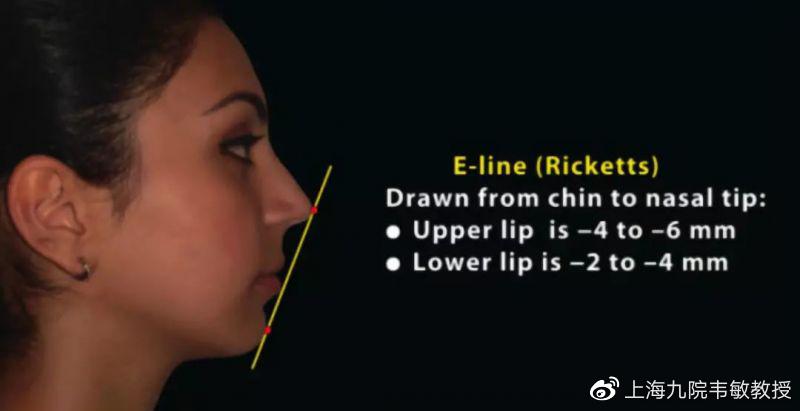 轻微嘴突正畸能达到正颌的效果吗,嘴歪正颌还是正畸怎么判断