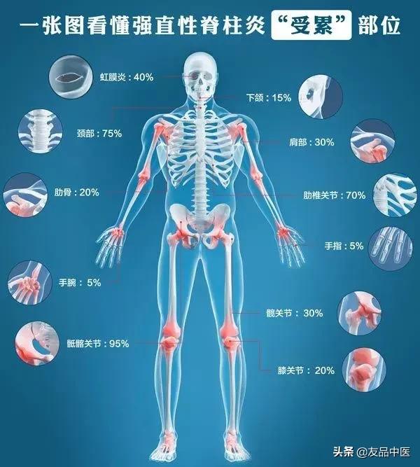 腰痛应该避免什么,腰痛你们是怎么治的