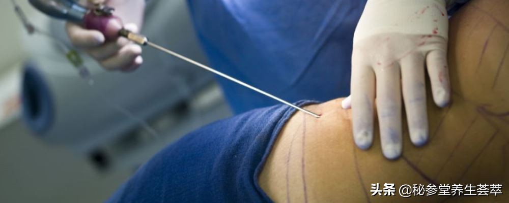 如何快速瘦小腿方法,瘦大腿和小腿最快方法儿童