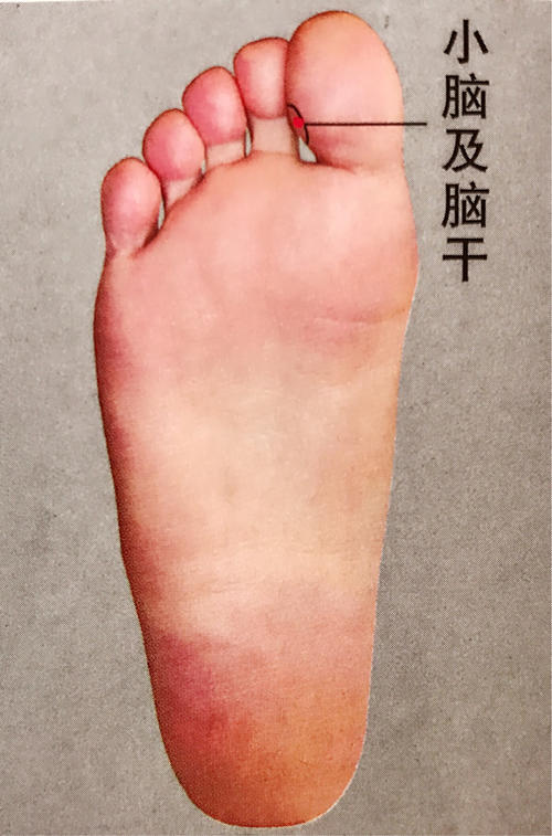 快速止疼的药头痛,偏头痛10秒止疼法真实有效