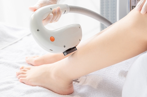 激光脱毛除腋臭,激光脱毛对毛囊