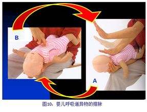 儿童眼下青紫是什么原因怎么治,宝宝脸色青紫是什么原因