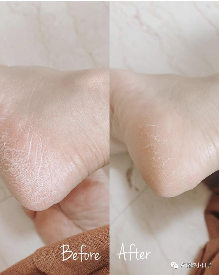 夏季天气炎热必备好物,夏天真的离不开这些好物