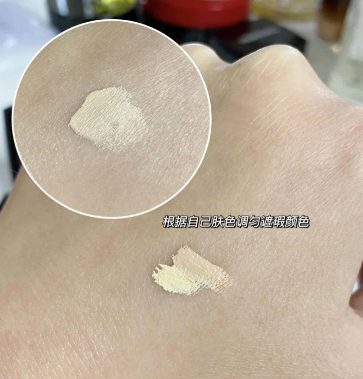 严重泪沟黑眼圈,淡化黑眼圈和泪沟原理