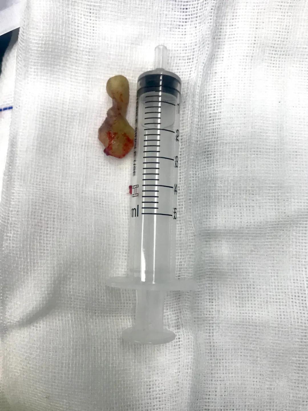 辽阳市第二人民医院耳鼻喉,辽阳市中医医院耳鼻喉科