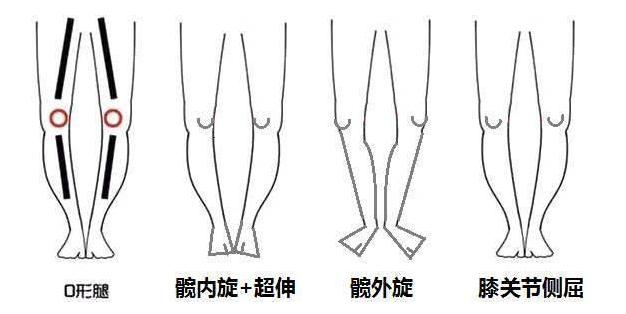 各种腿型适合什么样式的裤子,腿型不好看的适合什么裤子