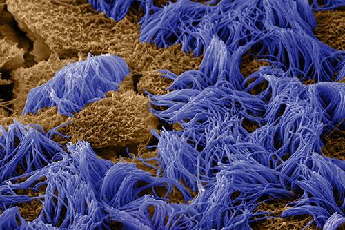 新冠肺炎的治疗指南最新,讲述新冠肺炎的症状与治疗